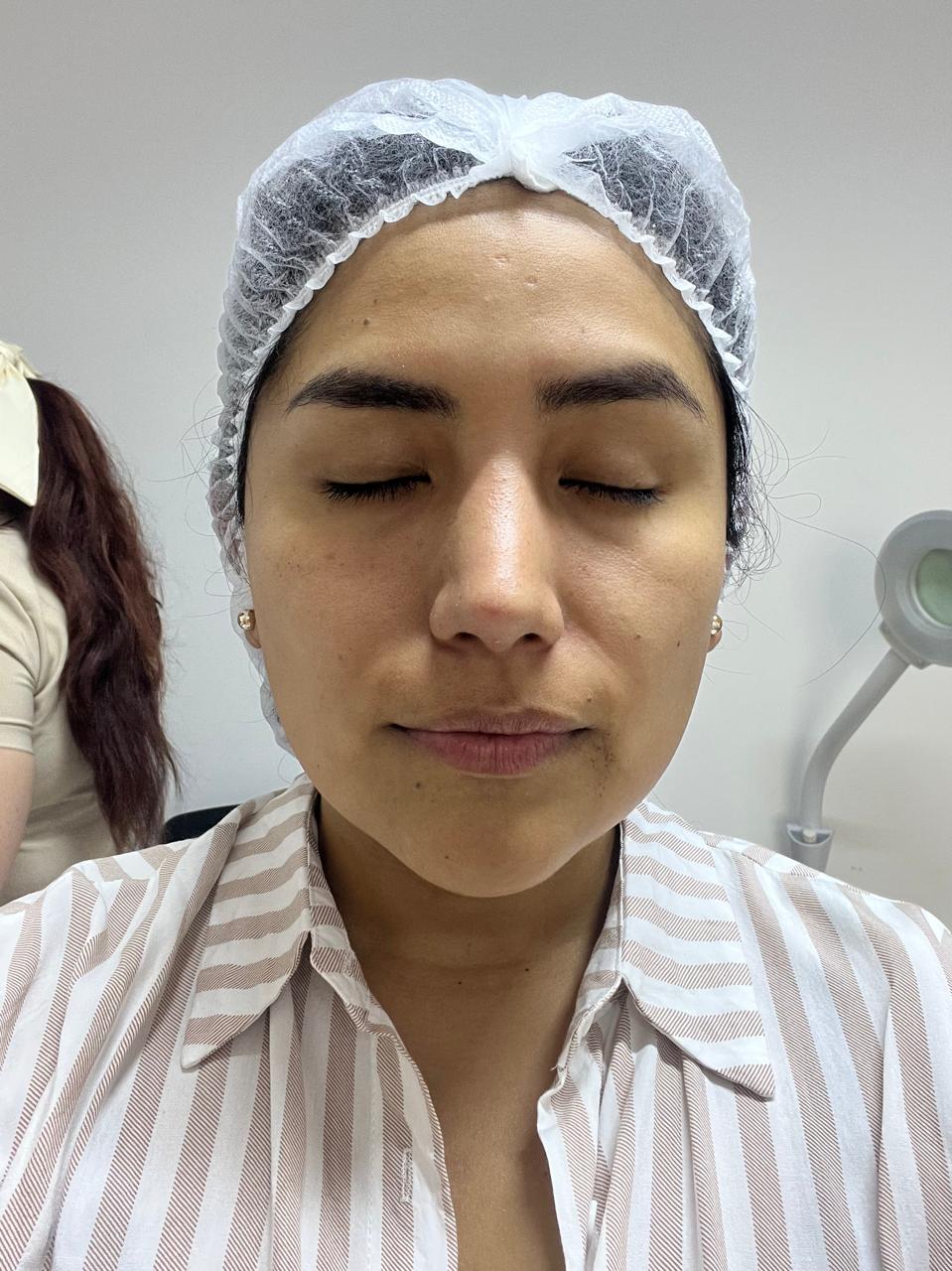 Después del tratamiento — resultado real 5, Klass Salón & Spa